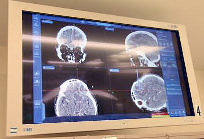 Brain scan at Monmouth Medical Center